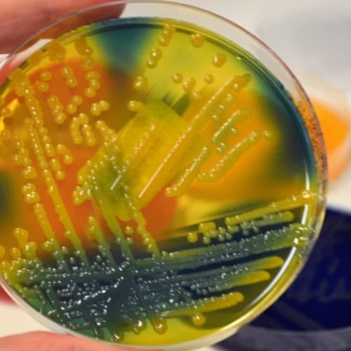 Biofilm Removal